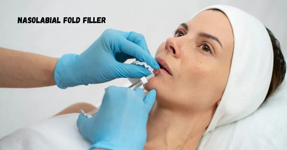 nasolabial fold filler